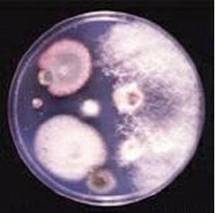 霉菌在培养皿上的形态
