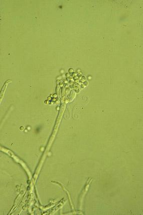 显微镜下的青霉菌