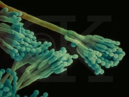 几种霉菌在显微镜下的形态特征图片一组